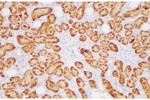 Immunohistochemistry of paraffin-embedded Rat kidney using GSTA1 Polycloanl Antibody at dilution of 1:200 (GSTA1 抗体)