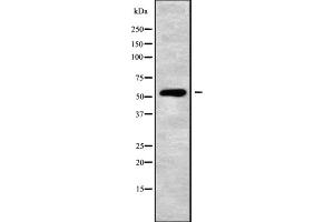 Western blot analysis of ATP6V1B2 using HT-29 whole cell lysates (ATP6V1B2 抗体  (C-Term))