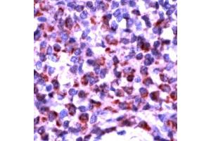 Human tonsil stained with Anti-Bak antibody (BAK1 抗体  (N-Term))