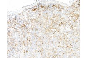 Immunohistochemistry (IHC) image for anti-Ectonucleoside Triphosphate diphosphohydrolase 1 (ENTPD1) (AA 300-350) antibody (ABIN7795686) (Recombinant CD39 抗体  (AA 300-350))