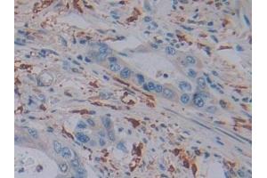Immunohistochemistry (IHC) image for anti-Ferritin, Light Polypeptide (FTL) (AA 2-175) antibody (ABIN7435310)