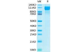 EGFR Protein (His-Avi Tag,Biotin)