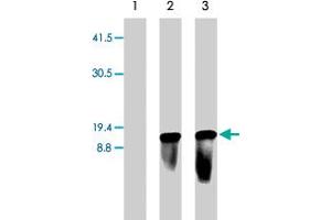 Western blot of 293 cells mock transfected (lane 1) or transiently transfected with pLenti6/TR lentiviral vector (lanes 2 & 3). (Blasticidin S Deaminase 抗体  (N-Term))