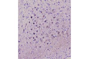 IHC analysis of NSE using anti-NSE antibody (ABIN6719549). (ENO2/NSE 抗体)