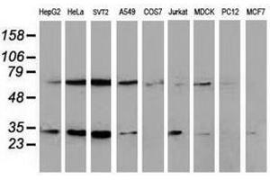 Image no. 4 for anti-Synovial Sarcoma, X Breakpoint 1 (SSX1) antibody (ABIN1501157)