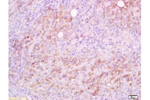 Formalin-fixed and paraffin embedded mouse lymphoma tissue labeled with Anti-CD5L/Api6 Polyclonal Antibody, Unconjugated (ABIN740985) at 1:200 followed by conjugation to the secondary antibody and DAB staining (CD5L 抗体  (AA 221-347))