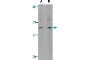 Western blot analysis of RASD2 in human colon tissue lysate with RASD2 polyclonal antibody  at (A) 1 and (B) 2 ug/mL . (RASD2 抗体  (C-Term))