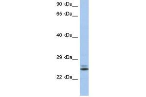 RAB15 antibody used at 1 ug/ml to detect target protein. (RAB15 抗体  (N-Term))