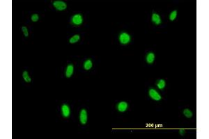 Immunofluorescence of monoclonal antibody to MPG on HeLa cell. (MPG 抗体  (AA 1-90))