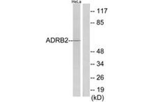 Western blot analysis of extracts from HeLa cells, using ADRB2 Antibody.
