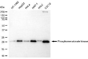 Western blotting analysis using phosphomevalonate kinase antibody (ABIN7799829).