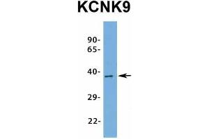 Western Blotting (WB) image for anti-Potassium Channel, Subfamily K, Member 9 (KCNK9) (N-Term) antibody (ABIN2776216)