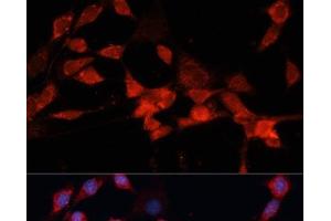 Immunofluorescence analysis of NIH-3T3 cells using DDB1 Polyclonal Antibody at dilution of 1:100 (40x lens). (DDB1 抗体)
