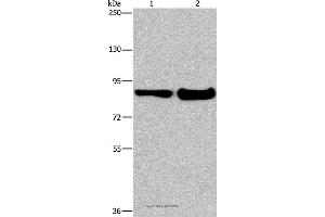 Western blot analysis of Mouse lung and liver tissue, using ECE1 Polyclonal Antibody at dilution of 1:1050 (MAPRE3 抗体)