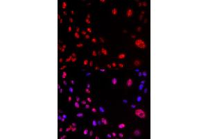 Immunofluorescence (IF) image for anti-Ataxia Telangiectasia Mutated (ATM) (pSer1981) antibody (ABIN1869997) (ATM 抗体  (pSer1981))