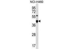CEACAM18 Antibody (N-term) western blot analysis in NCI-H460 cell line lysates (35µg/lane). (CEACAM18 抗体  (N-Term))