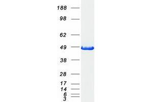 Western Blotting (WB) image for Cysteine-S-conjugate beta-Lyase (CCBL1) (Transcript Variant 1) (Active) protein (Myc-DYKDDDDK Tag) (ABIN2713271)