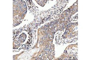 IHC analysis of MUT using anti-MUT antibody (ABIN4886676). (MUT 抗体  (N-Term))