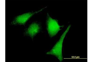 Immunofluorescence of purified MaxPab rabbit antibody to MAP2K2 on HeLa cell. (MEK2 抗体  (AA 1-400))