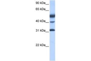 Western Blotting (WB) image for anti-Activating Transcription Factor 1 (AFT1) antibody (ABIN2461743) (AFT1 抗体)