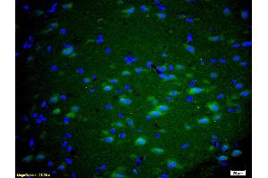 Formalin-fixed and paraffin embedded rat brain labeled with Anti GRM5/mGluR5 Polyclonal Antibody, Unconjugated (ABIN673914) at 1:200 followed by conjugation to the secondary antibody Goat Anti-Rabbit IgG, FITC conjugated used at 1:200 dilution for 40 minutes at 37°C and DAPI staining. (Metabotropic Glutamate Receptor 5 抗体  (AA 201-300))