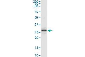 NAT6 MaxPab rabbit polyclonal antibody. (NAT6 抗体  (AA 1-308))