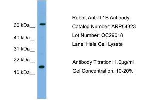 WB Suggested Anti-IL1B  Antibody Titration: 0.