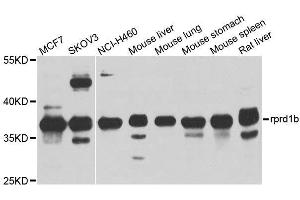 Western blot analysis of extracts of various cell lines, using rprd1b antibody. (RPRD1B 抗体)