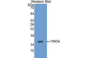 Western Blotting (WB) image for anti-Hexosaminidase B (Beta Polypeptide) (HEXB) (AA 101-217) antibody (ABIN3208193) (HEXB 抗体  (AA 101-217))