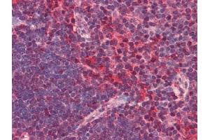 Image no. 1 for anti-Chemokine (C-X-C Motif) Receptor 6 (CXCR6) antibody (ABIN372833) (CXCR6 抗体)