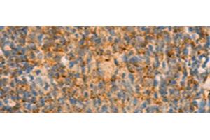Immunohistochemistry of paraffin-embedded Human tonsil tissue using IFITM2 Polyclonal Antibody at dilution of 1:25(x200) (IFITM2 抗体)