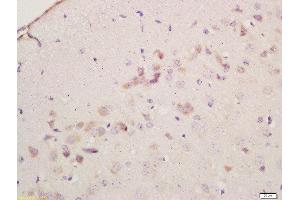 Formalin-fixed and paraffin embedded mouse brain labeled with Anti-Cyclooxygenase-2 Polyclonal Antibody, Unconjugated  at 1:200 followed by conjugation to the secondary antibody and DAB staining (PTGS2 抗体  (AA 301-400))