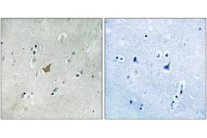 Immunohistochemistry analysis of paraffin-embedded human brain, using EPHA3/4/5 (Phospho-Tyr779/833) Antibody. (EPH Receptor A3 抗体  (pTyr779))