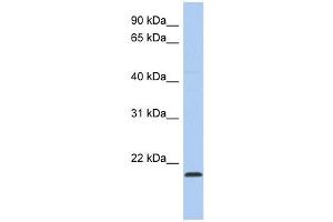 RWDD4A antibody used at 1 ug/ml to detect target protein. (RWDD4A 抗体  (Middle Region))