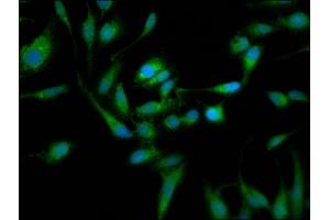 Immunofluorescence staining of Hela cells with ABIN7172295 at 1:105, counter-stained with DAPI.