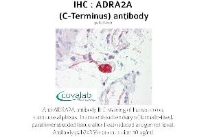 Image no. 1 for anti-Alpha-2A Adrenergic Receptor (ADRA2A) antibody (ABIN1731578) (ADRA2A 抗体)