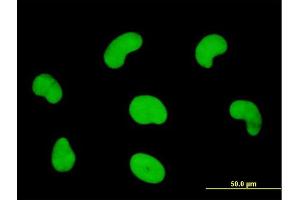 Immunofluorescence of monoclonal antibody to HDGFRP3 on HeLa cell. (HDGFRP3 抗体  (AA 1-203))