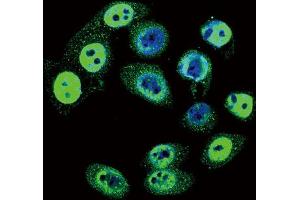 Immunofluorescence (IF) image for anti-SMAD Family Member 4 (SMAD4) (pThr277) antibody (ABIN3001788) (SMAD4 抗体  (pThr277))