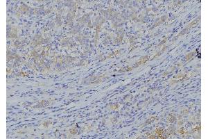 ABIN6277564 at 1/100 staining Human gastric tissue by IHC-P.