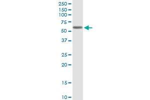 Western Blotting (WB) image for anti-Potassium Voltage-Gated Channel, Shaker-Related Subfamily, Member 1 (KCNA1) (AA 1-495) antibody (ABIN517305)