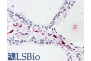Immunohistochemistry (IHC) image for anti-ATPase Type 13A1 (ATP13A1) (Internal Region) antibody (ABIN238640)