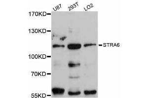Western blot analysis of extracts of various cell lines, using STRA6 antibody (ABIN5998994) at 1:3000 dilution. (STRA6 抗体)