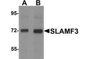 Western blot analysis of SLAMF3 / CD229 in 293 cell lysate with SLAMF3 antibody at (A) 1 and (B) 2 μg/ml. (LY9 抗体  (C-Term))