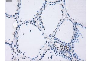 Immunohistochemical staining of paraffin-embedded Kidney tissue using anti-PSMA7mouse monoclonal antibody. (PSMA7 抗体)