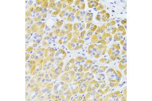 Immunohistochemistry of paraffin-embedded rat kidney using FAS Antibody (ABIN5970062) at dilution of 1/100 (40x lens). (FAS 抗体)