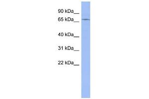 WB Suggested Anti-ZNF133 Antibody Titration:  0.