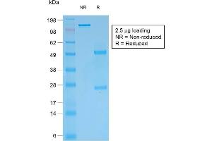 SDS-PAGE Analysis Purified Multi-Cytokeratin Mouse Recombinant Monoclonal Antibody (rKRT/457). (Recombinant Cytokeratin, Multi (Epithelial Marker) 抗体)