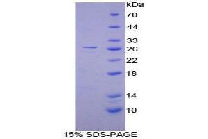SDS-PAGE (SDS) image for Calcium/calmodulin-Dependent Protein Kinase II gamma (CAMK2G) (AA 6-208) protein (His tag) (ABIN1879728) (CAMKII gamma Protein (AA 6-208) (His tag))