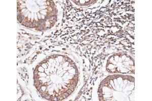 Immunohistochemistry (Paraffin-embedded Sections) (IHC (p)) image for anti-Kinesin Family Member 14 (KIF14) antibody (ABIN7255237)