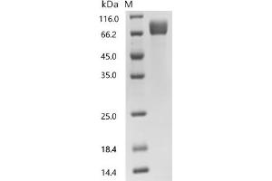 (Tris-Glycine gel) Discontinuous SDS-PAGE (reduced) with 5 % enrichment gel and 15 % separation gel.
